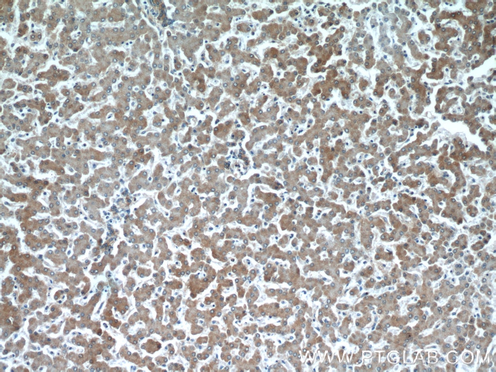 Immunohistochemistry (IHC) staining of human liver tissue using SERPINA10 Polyclonal antibody (11851-1-AP)