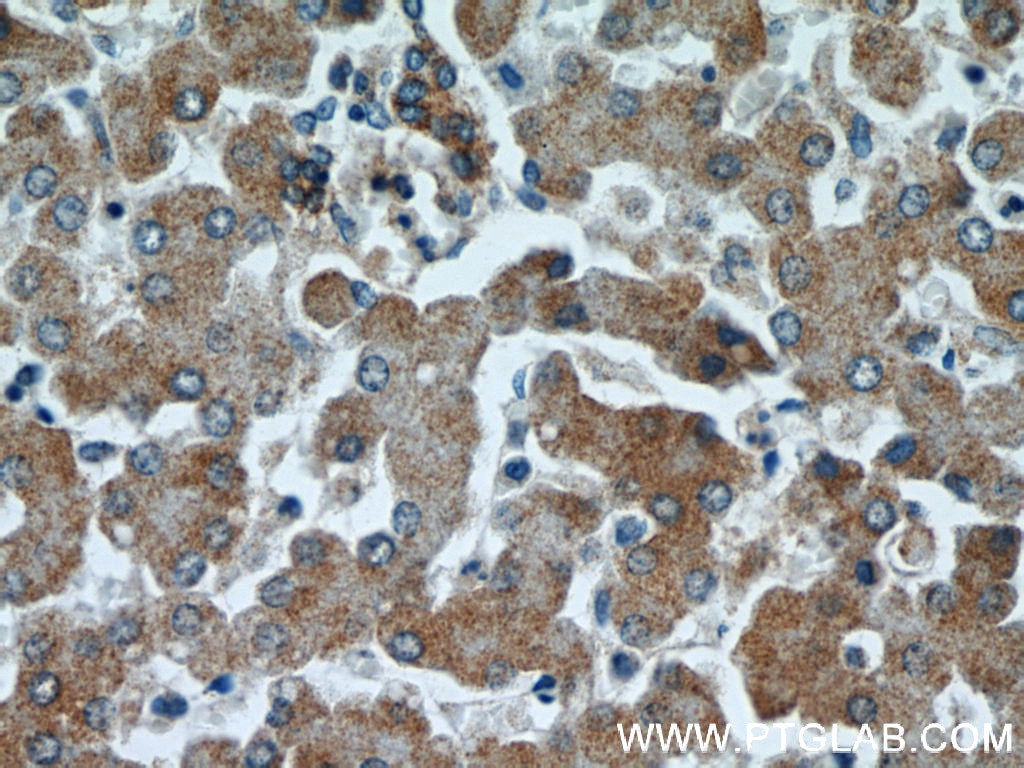 Immunohistochemistry (IHC) staining of human liver tissue using SERPINA10 Polyclonal antibody (11851-1-AP)