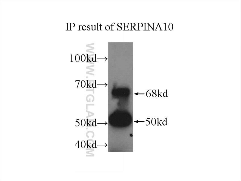 Immunoprecipitation (IP) experiment of L02 cells using SERPINA10 Polyclonal antibody (11851-1-AP)
