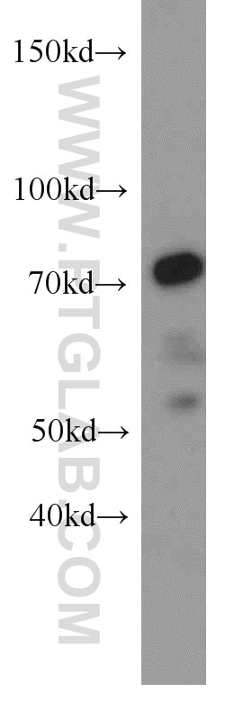Western Blot (WB) analysis of mouse liver tissue using SERPINA10 Polyclonal antibody (11851-1-AP)