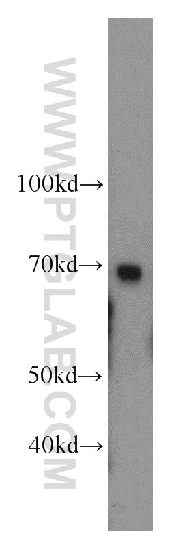 Western Blot (WB) analysis of mouse liver tissue using SERPINA10 Polyclonal antibody (11851-1-AP)