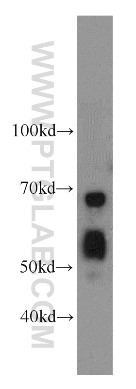 Western Blot (WB) analysis of mouse liver tissue using SERPINA10 Polyclonal antibody (11851-1-AP)