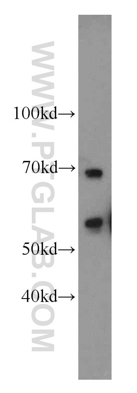 Western Blot (WB) analysis of RAW264.7 using SERPINA10 Polyclonal antibody (11851-1-AP)