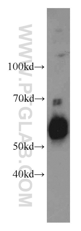 WB analysis of mouse liver using 11851-1-AP