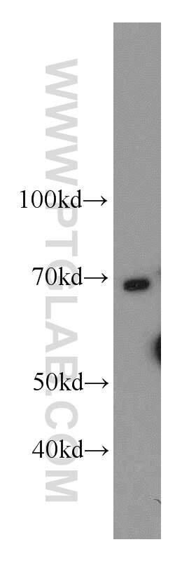 Western Blot (WB) analysis of HepG2 cells using SERPINA10 Polyclonal antibody (11851-1-AP)