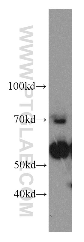 Western Blot (WB) analysis of HepG2 cells using SERPINA10 Polyclonal antibody (11851-1-AP)
