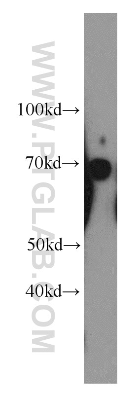 Western Blot (WB) analysis of L02 cells using SERPINA10 Polyclonal antibody (11851-1-AP)