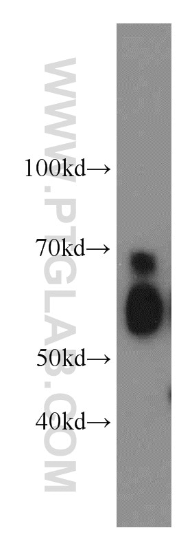 Western Blot (WB) analysis of L02 cells using SERPINA10 Polyclonal antibody (11851-1-AP)