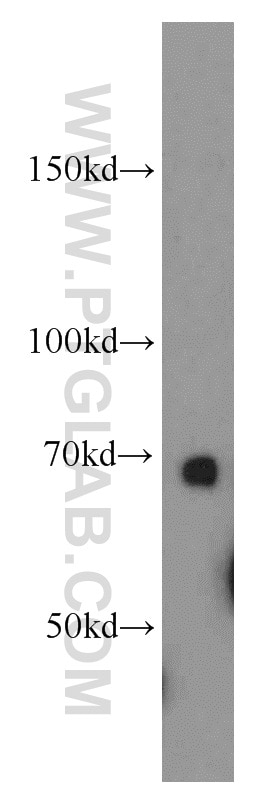 Western Blot (WB) analysis of HepG2 cells using SERPINA10 Polyclonal antibody (11851-1-AP)
