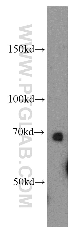 WB analysis of HepG2 using 11851-1-AP