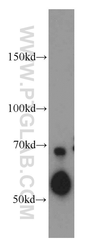 Western Blot (WB) analysis of HepG2 cells using SERPINA10 Polyclonal antibody (11851-1-AP)