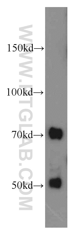 Western Blot (WB) analysis of mouse liver tissue using SERPINA10 Polyclonal antibody (11851-1-AP)