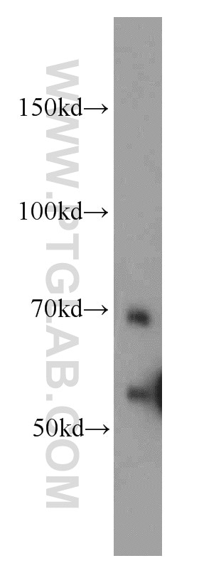 Western Blot (WB) analysis of RAW264.7 using SERPINA10 Polyclonal antibody (11851-1-AP)