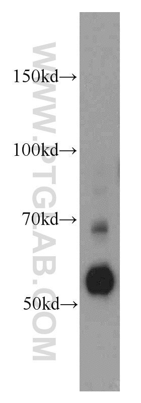Western Blot (WB) analysis of RAW264.7 using SERPINA10 Polyclonal antibody (11851-1-AP)