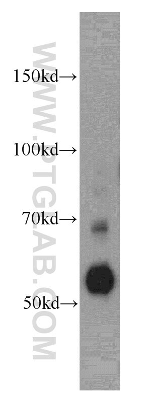 Western Blot (WB) analysis of RAW264.7 using SERPINA10 Polyclonal antibody (11851-1-AP)