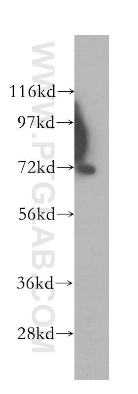 Western Blot (WB) analysis of human liver tissue using SERPINA10 Polyclonal antibody (11851-1-AP)