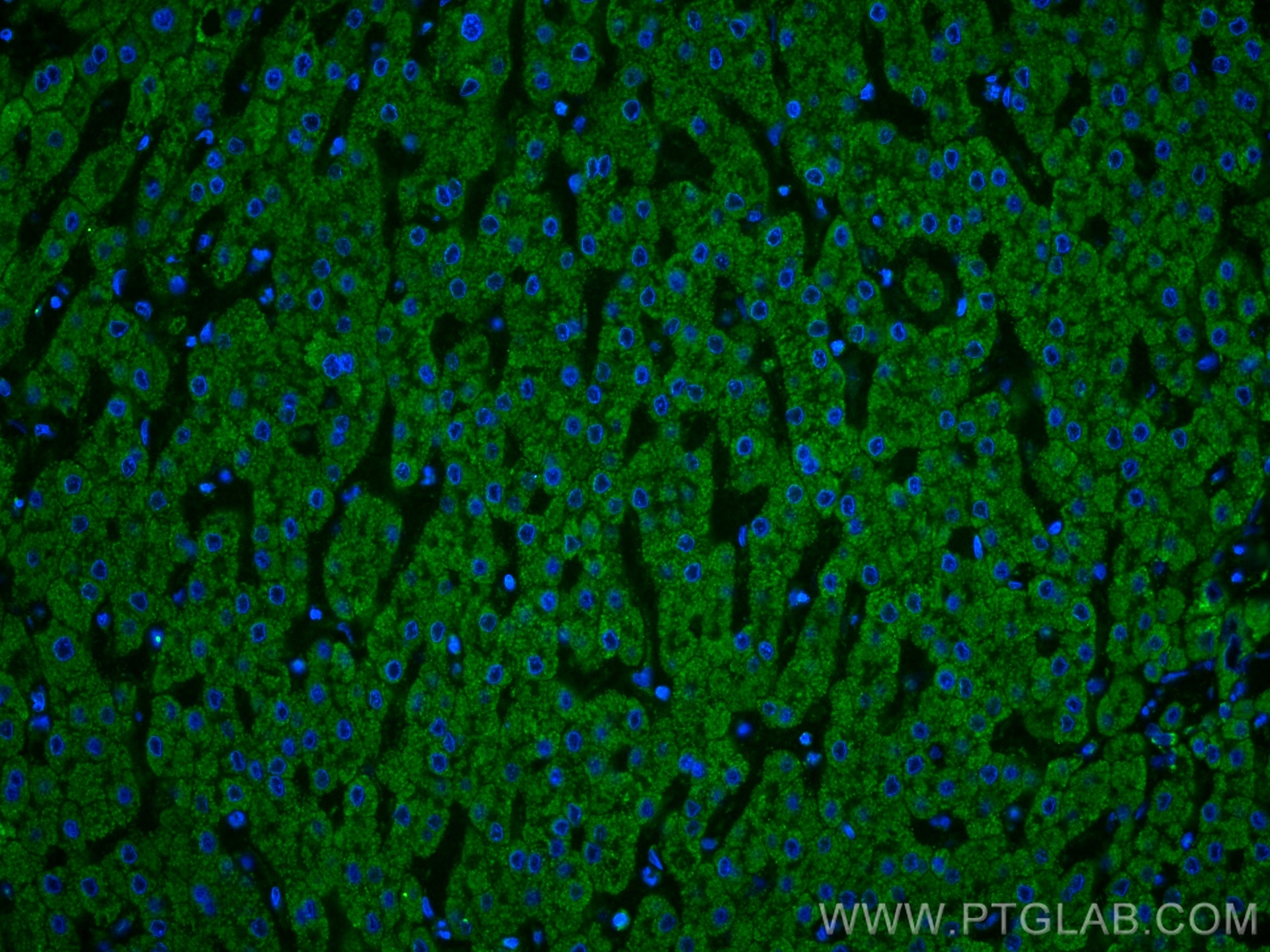 Immunofluorescence (IF) / fluorescent staining of human liver tissue using SERPINA10 Monoclonal antibody (60113-1-Ig)