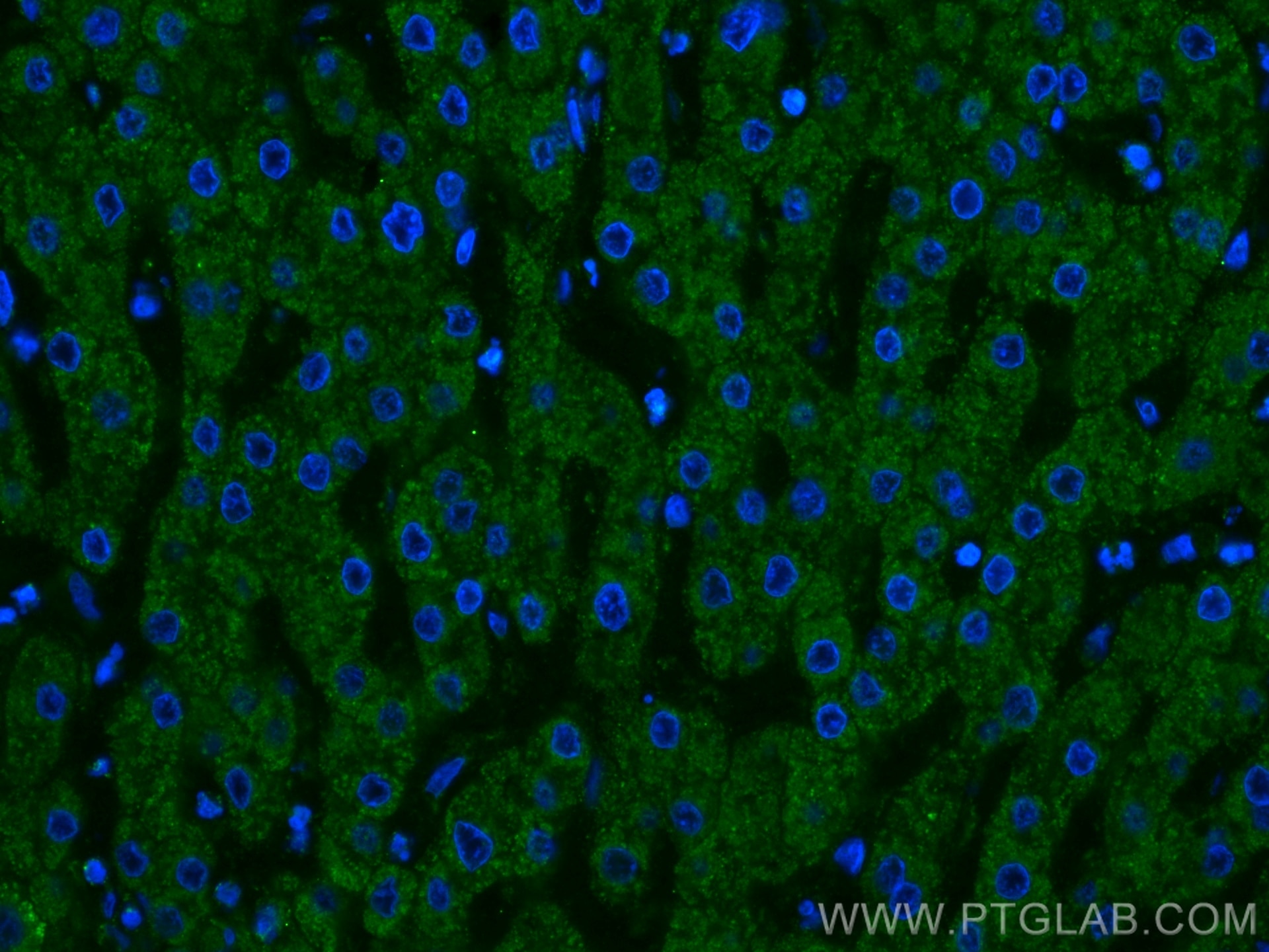Immunofluorescence (IF) / fluorescent staining of human liver tissue using SERPINA10 Monoclonal antibody (60113-1-Ig)