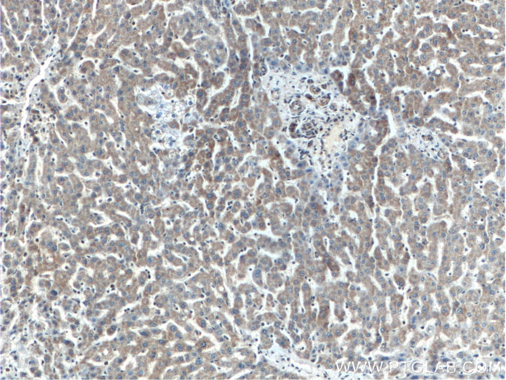 Immunohistochemistry (IHC) staining of human liver tissue using SERPINA10 Monoclonal antibody (60113-1-Ig)