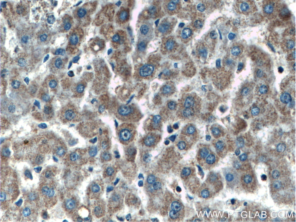 Immunohistochemistry (IHC) staining of human liver tissue using SERPINA10 Monoclonal antibody (60113-1-Ig)