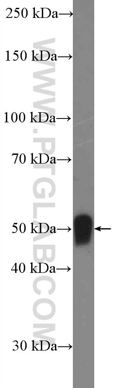 Western Blot (WB) analysis of human adipose tissue using Vaspin Polyclonal antibody (17451-1-AP)