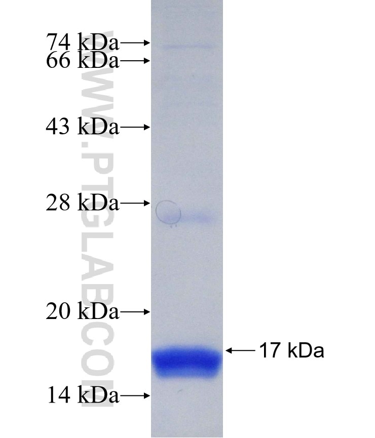 SERPINA12 fusion protein Ag30136 SDS-PAGE