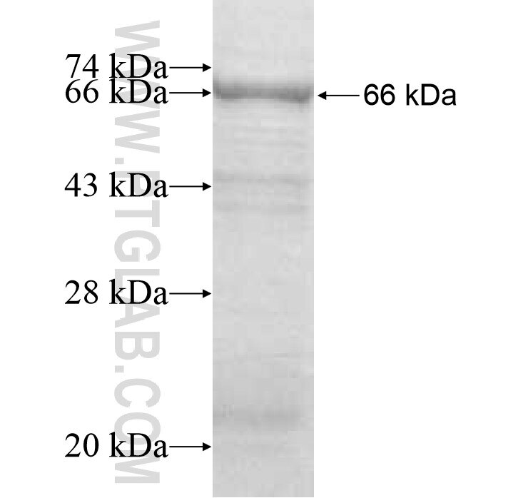 SERPINA12 fusion protein Ag11574 SDS-PAGE
