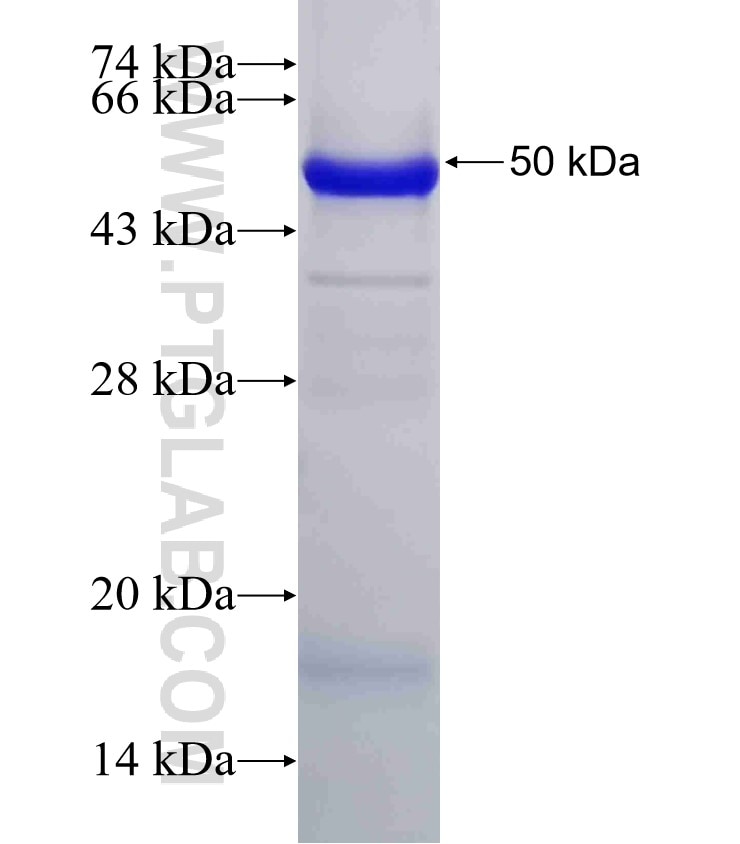 SERPINA12 fusion protein Ag11621 SDS-PAGE
