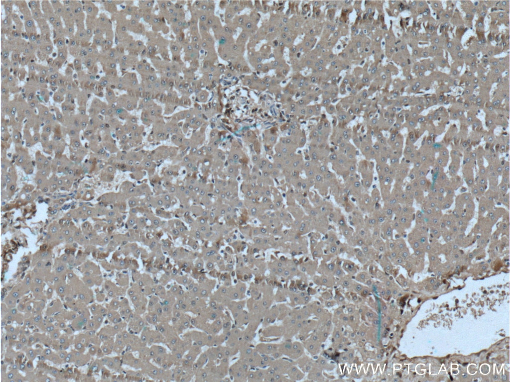 Immunohistochemistry (IHC) staining of human liver tissue using Alpha Antichymotrypsin Polyclonal antibody (12192-1-AP)