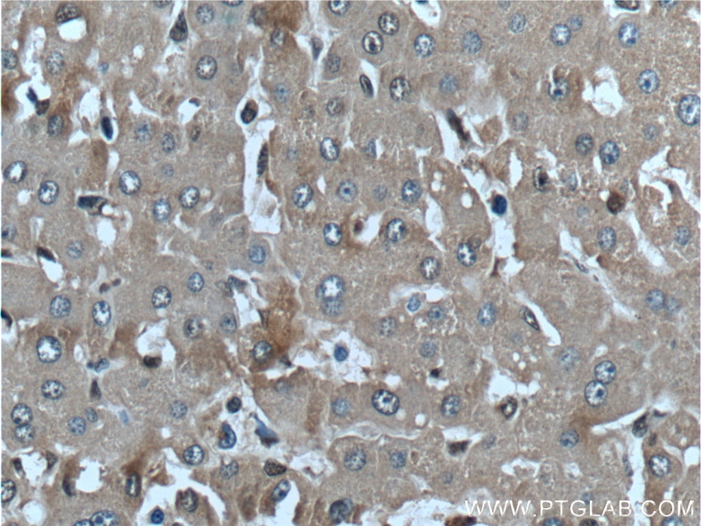 IHC staining of human liver using 12192-1-AP