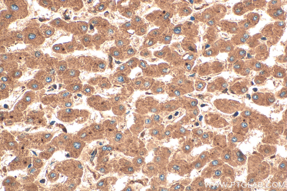 Immunohistochemistry (IHC) staining of human liver tissue using Alpha 1 antichymotrypsin Polyclonal antibody (12192-1-AP)