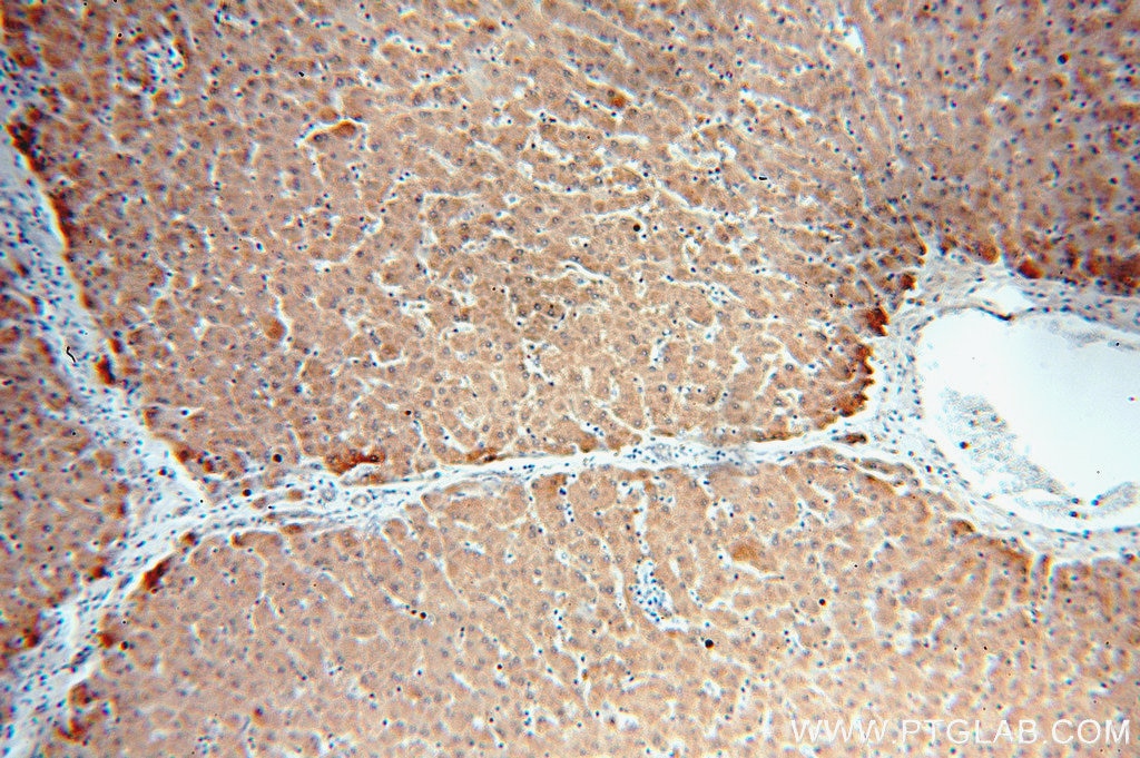 IHC staining of human liver using 12192-1-AP