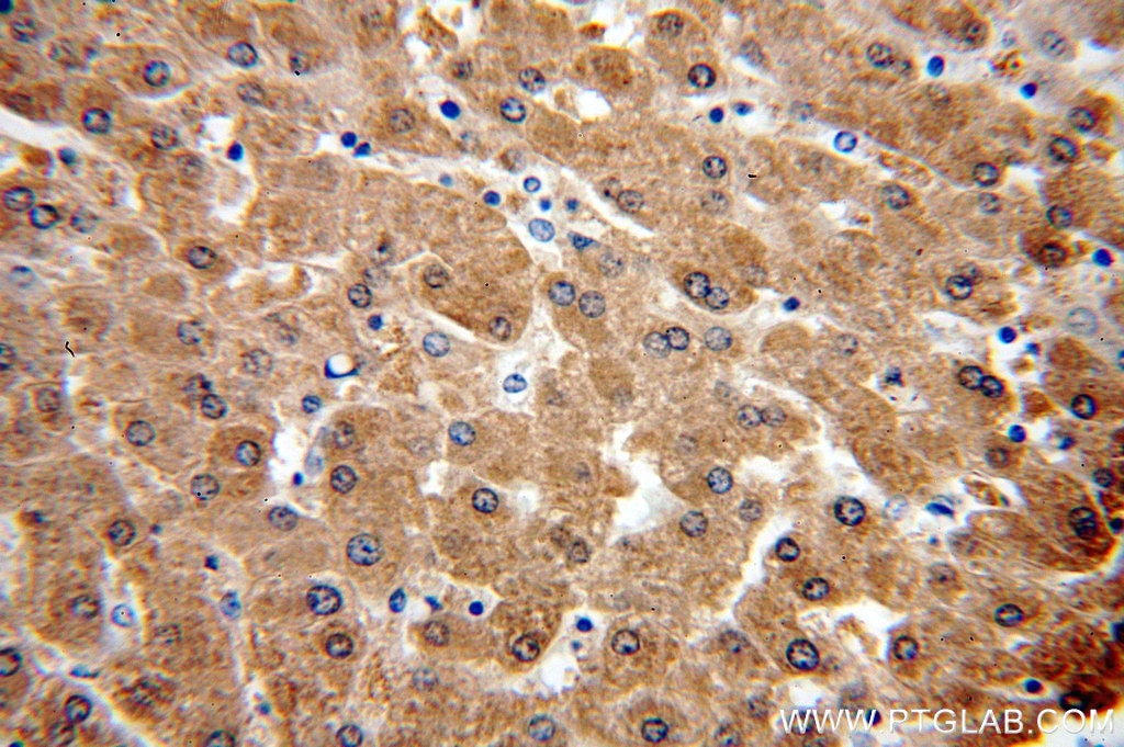 IHC staining of human liver using 12192-1-AP