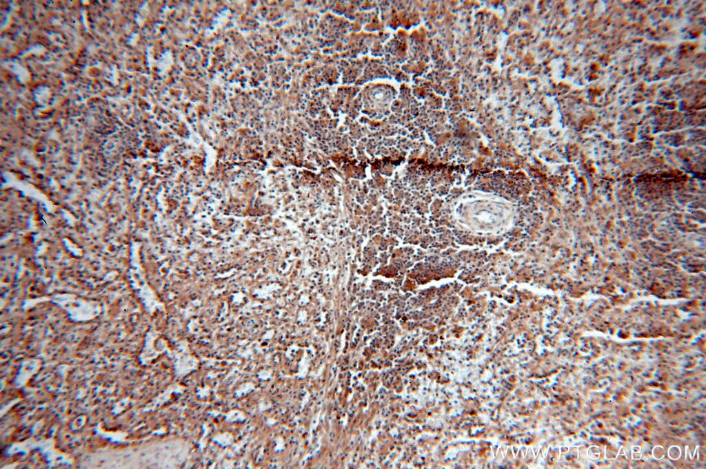 Immunohistochemistry (IHC) staining of human spleen tissue using Alpha Antichymotrypsin Polyclonal antibody (12192-1-AP)