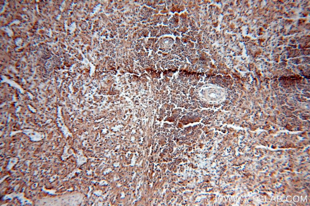 IHC staining of human spleen using 12192-1-AP