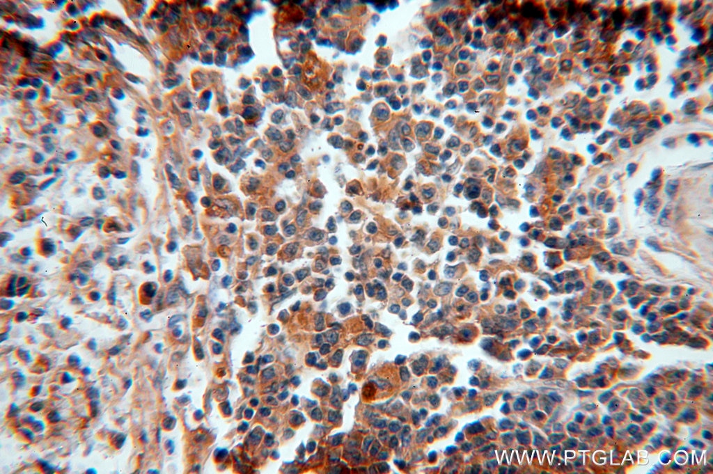 Immunohistochemistry (IHC) staining of human spleen tissue using Alpha Antichymotrypsin Polyclonal antibody (12192-1-AP)