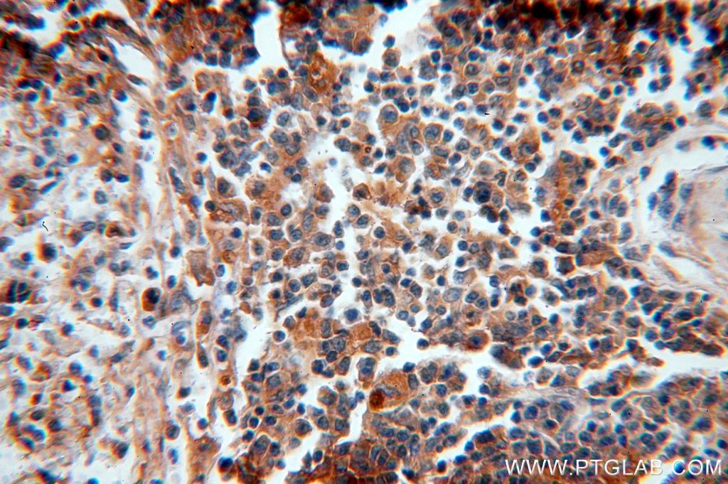 Immunohistochemistry (IHC) staining of human spleen tissue using Alpha Antichymotrypsin Polyclonal antibody (12192-1-AP)