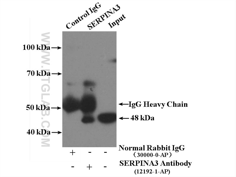 Immunoprecipitation (IP) experiment of COLO 320 cells using Alpha Antichymotrypsin Polyclonal antibody (12192-1-AP)