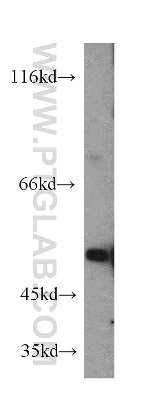 Western Blot (WB) analysis of COLO 320 cells using Alpha Antichymotrypsin Polyclonal antibody (12192-1-AP)