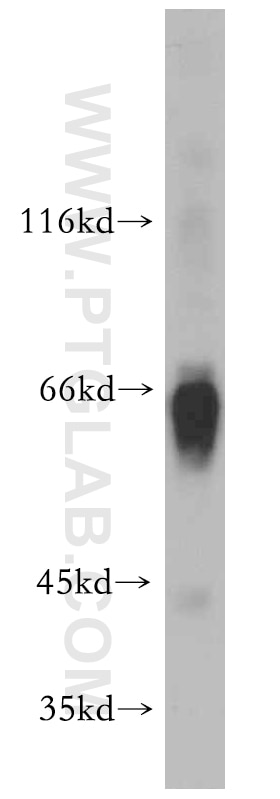 Western Blot (WB) analysis of human plasma using Alpha Antichymotrypsin Polyclonal antibody (12192-1-AP)