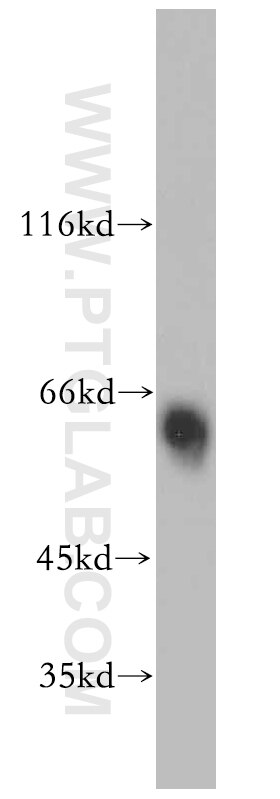 Western Blot (WB) analysis of human colon tissue using Alpha Antichymotrypsin Polyclonal antibody (12192-1-AP)