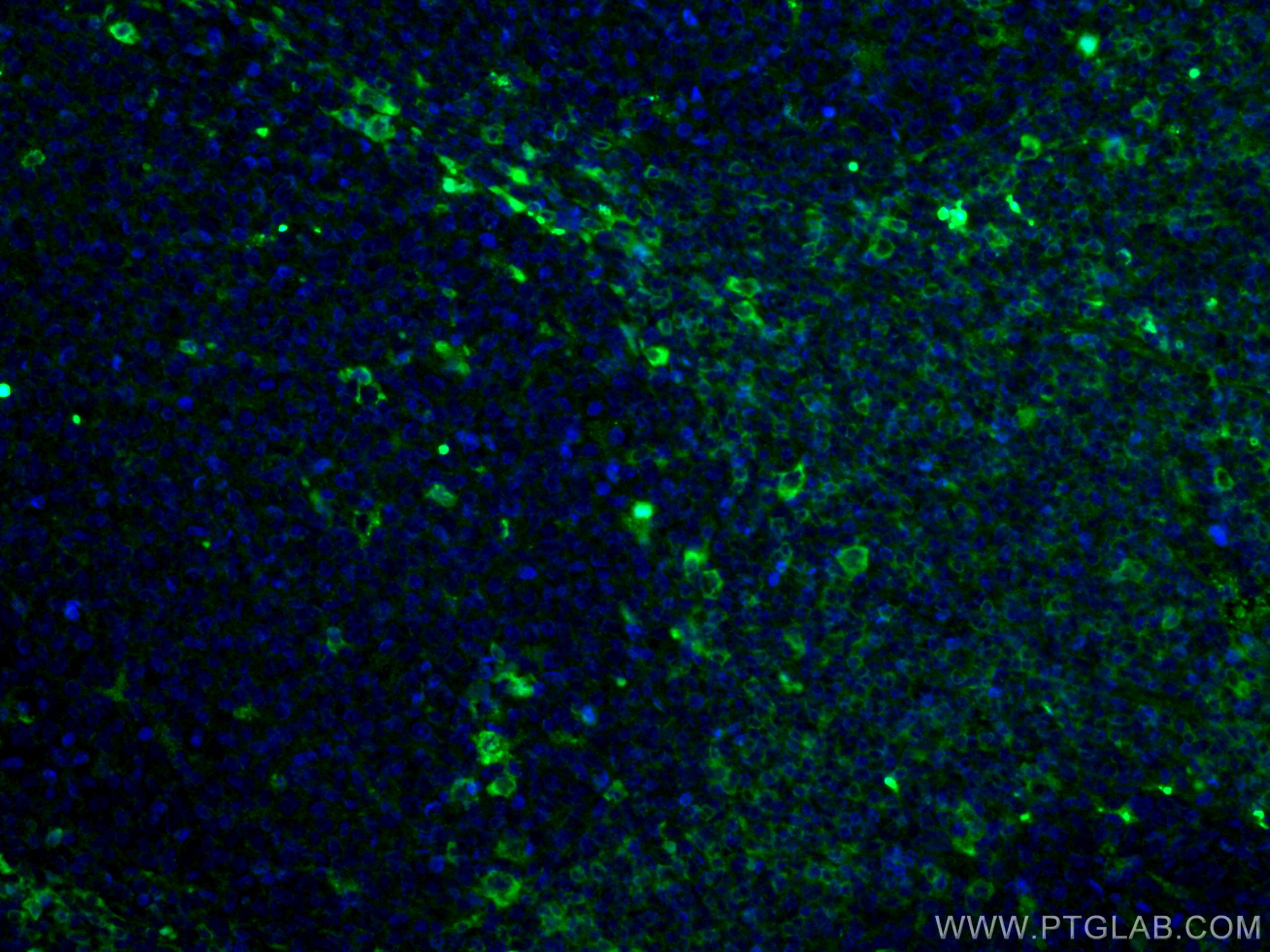 Immunofluorescence (IF) / fluorescent staining of human tonsillitis tissue using Alpha Antichymotrypsin Monoclonal antibody (66078-1-Ig)