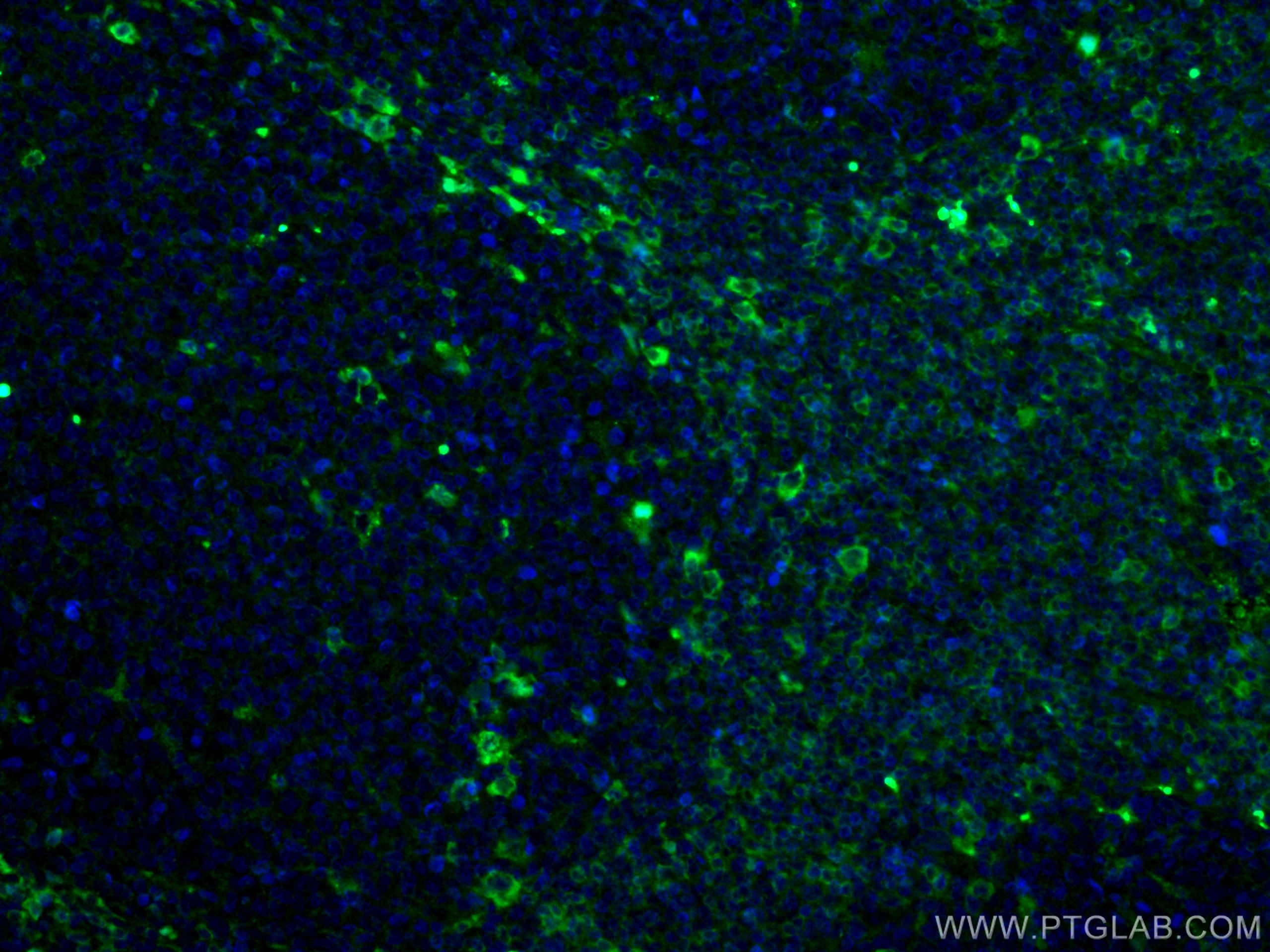 Immunofluorescence (IF) / fluorescent staining of human tonsillitis tissue using Alpha 1 antichymotrypsin Monoclonal antibody (66078-1-Ig)