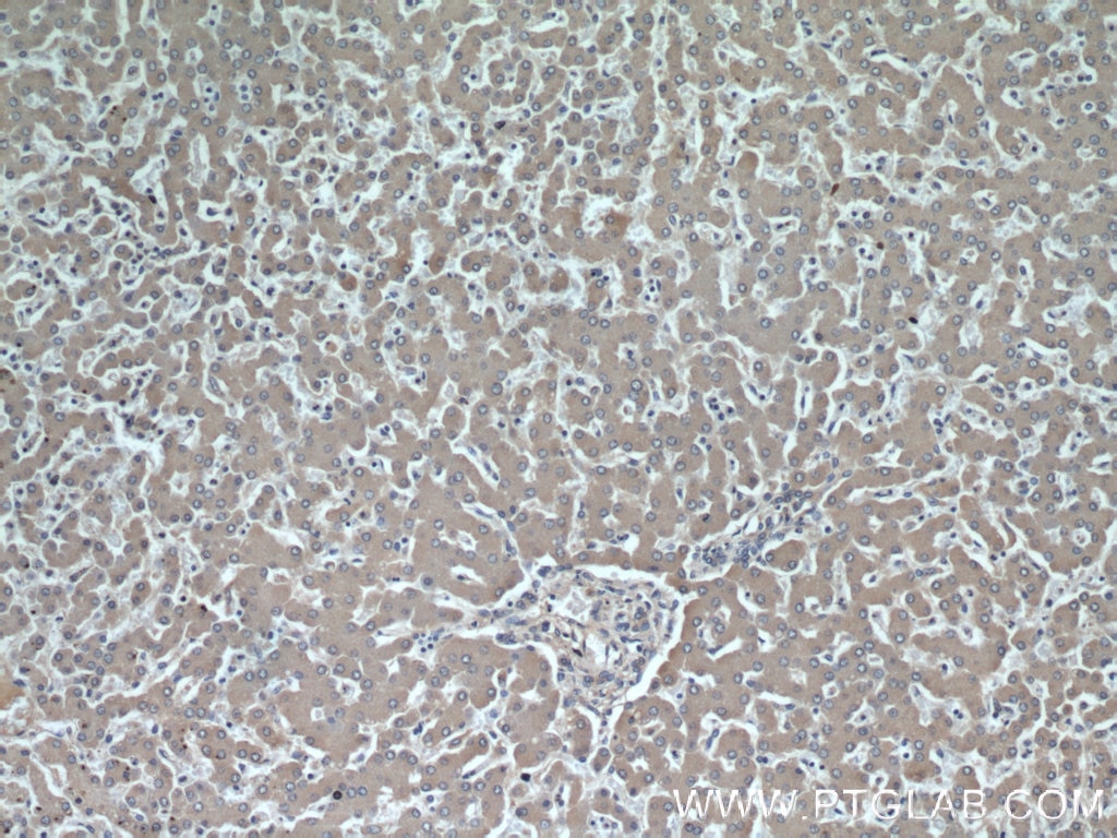 Immunohistochemistry (IHC) staining of human liver tissue using Alpha Antichymotrypsin Monoclonal antibody (66078-1-Ig)