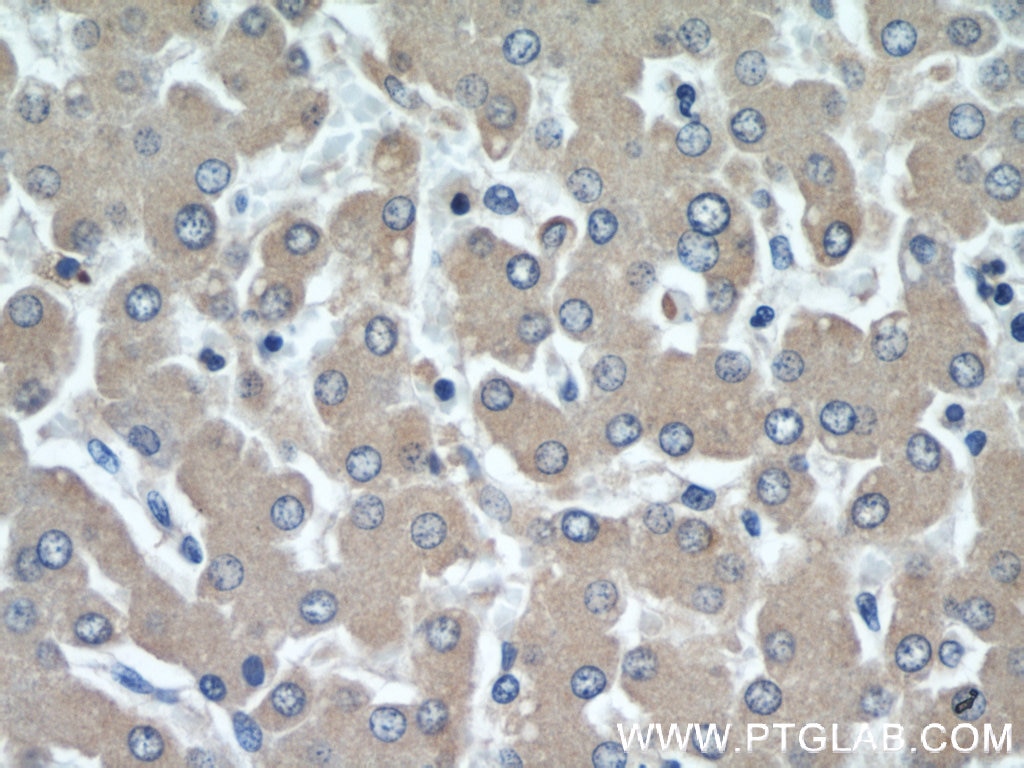 Immunohistochemistry (IHC) staining of human liver tissue using Alpha Antichymotrypsin Monoclonal antibody (66078-1-Ig)