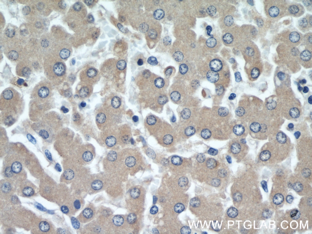 IHC staining of human liver using 66078-1-Ig