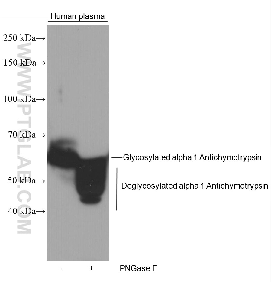 Western Blot (WB) analysis of human plasma using Alpha Antichymotrypsin Monoclonal antibody (66078-1-Ig)