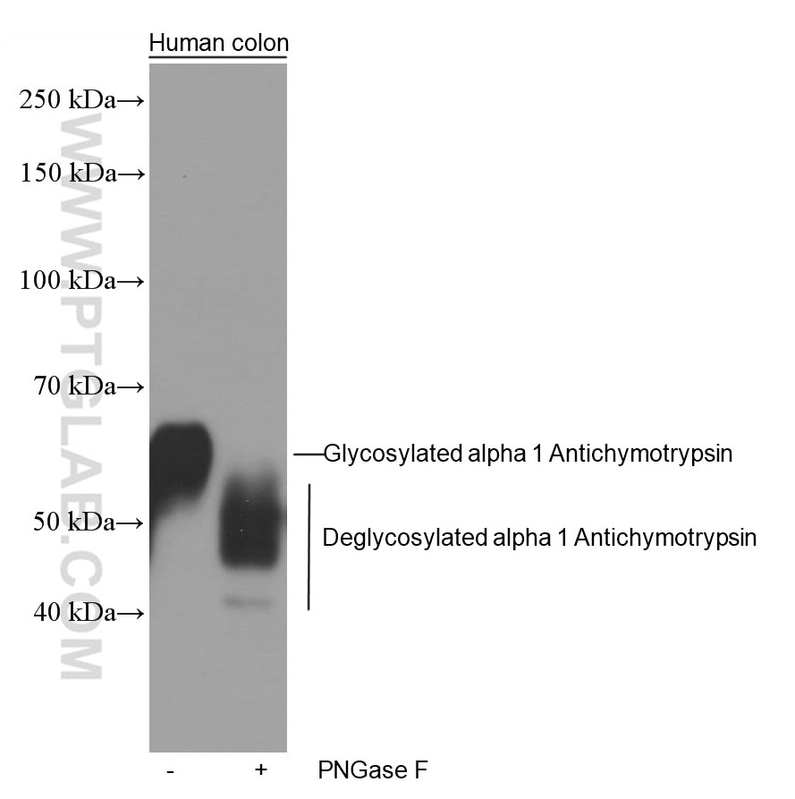 Western Blot (WB) analysis of human colon tissue using Alpha Antichymotrypsin Monoclonal antibody (66078-1-Ig)