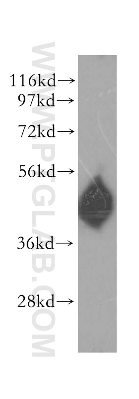 WB analysis of human spleen using 11430-2-AP