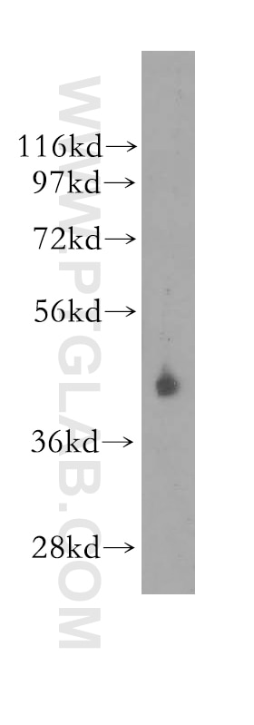 Western Blot (WB) analysis of human plasma using Kallistatin Polyclonal antibody (11430-2-AP)